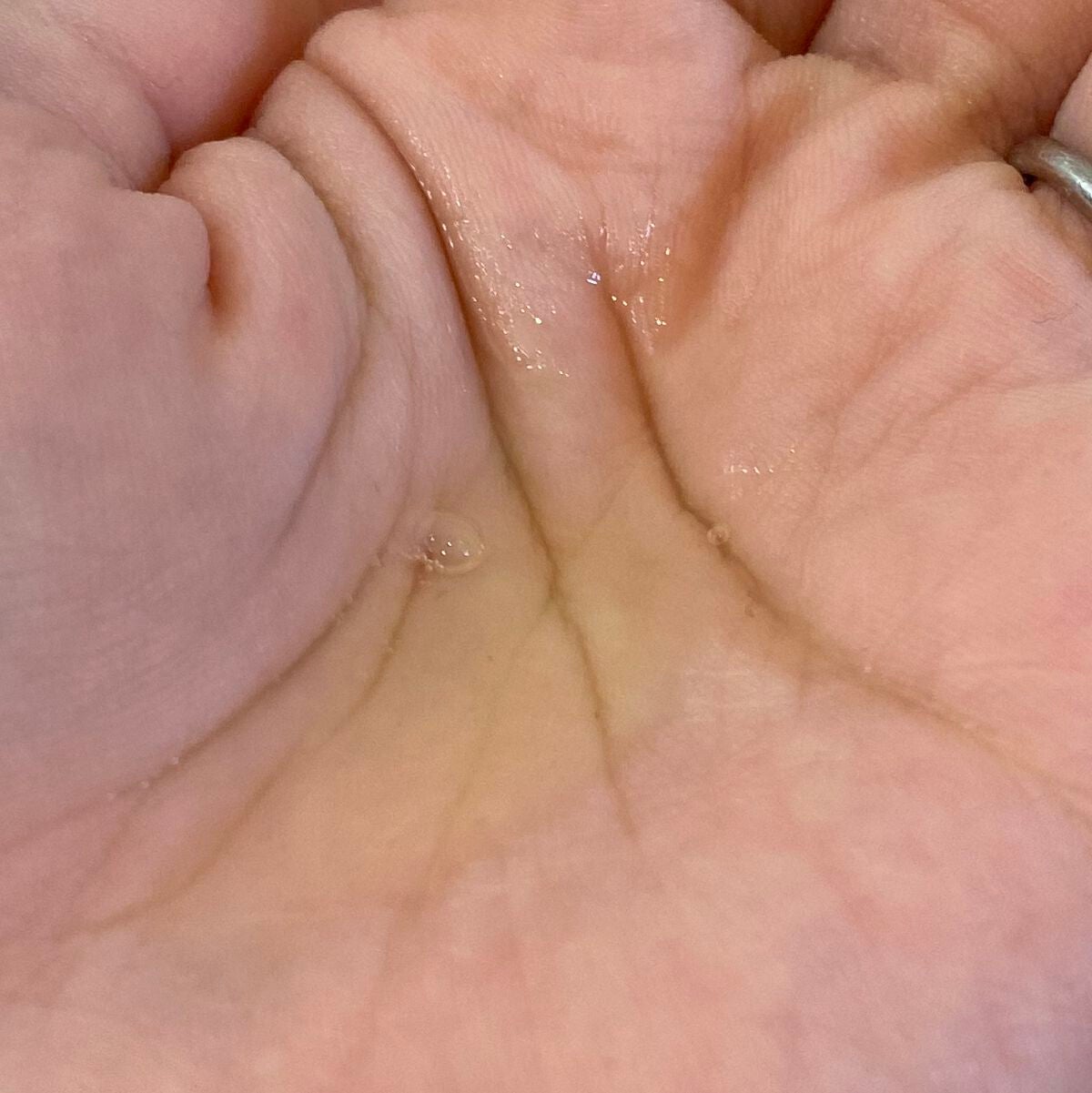 V エッセンス/unlabel/美容液を使ったクチコミ(5枚目)