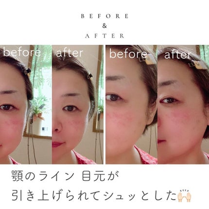 AGE-R専用ジェルセラム/MEDICUBE/美容液を使ったクチコミ(6枚目)