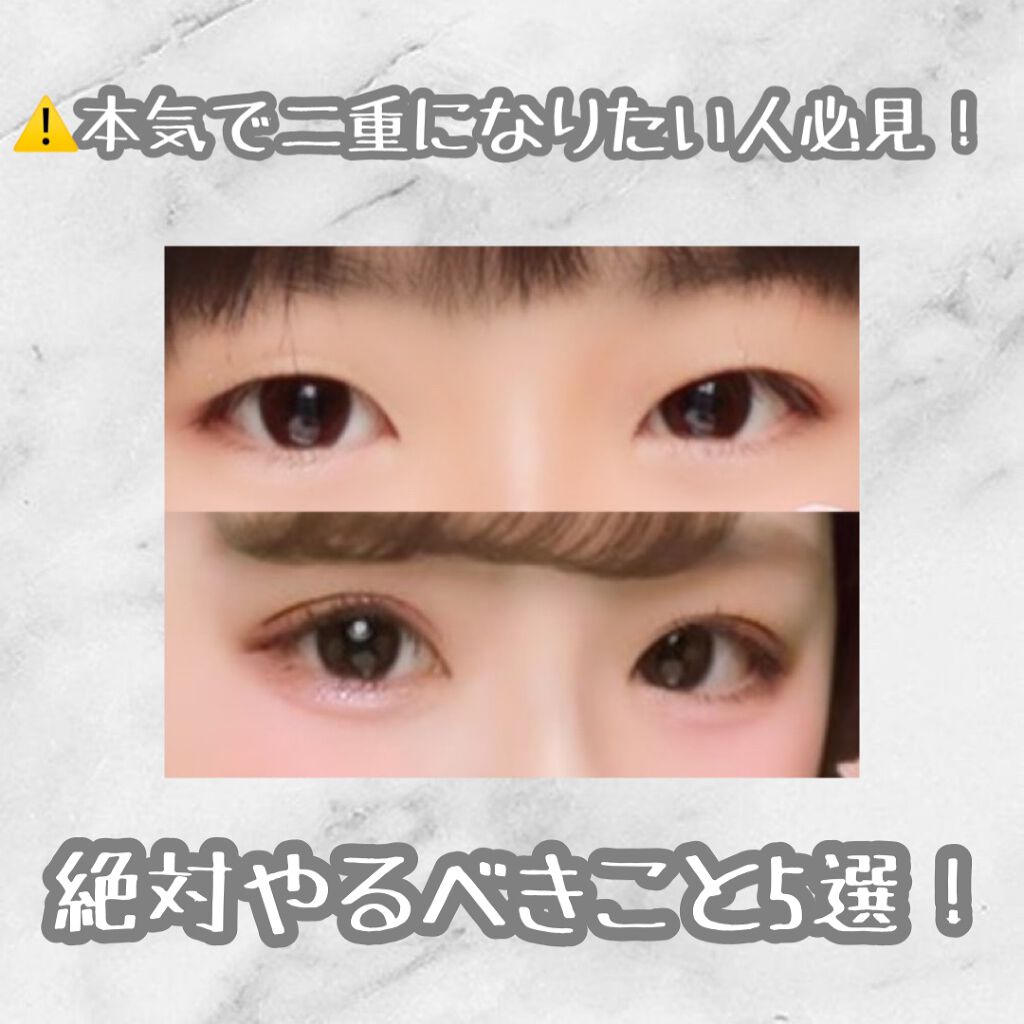 アイトーク/アイトーク/二重まぶた用アイテムを使ったクチコミ（1枚目）