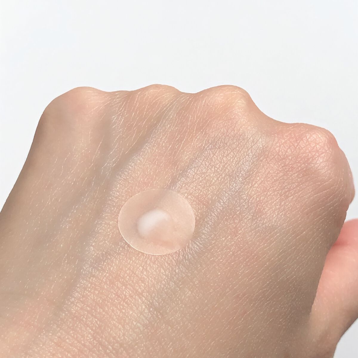 薬用 美白アクネホワイトクリーム 専用パッチ付/アクネスラボ/その他キットセットを使ったクチコミ(5枚目)