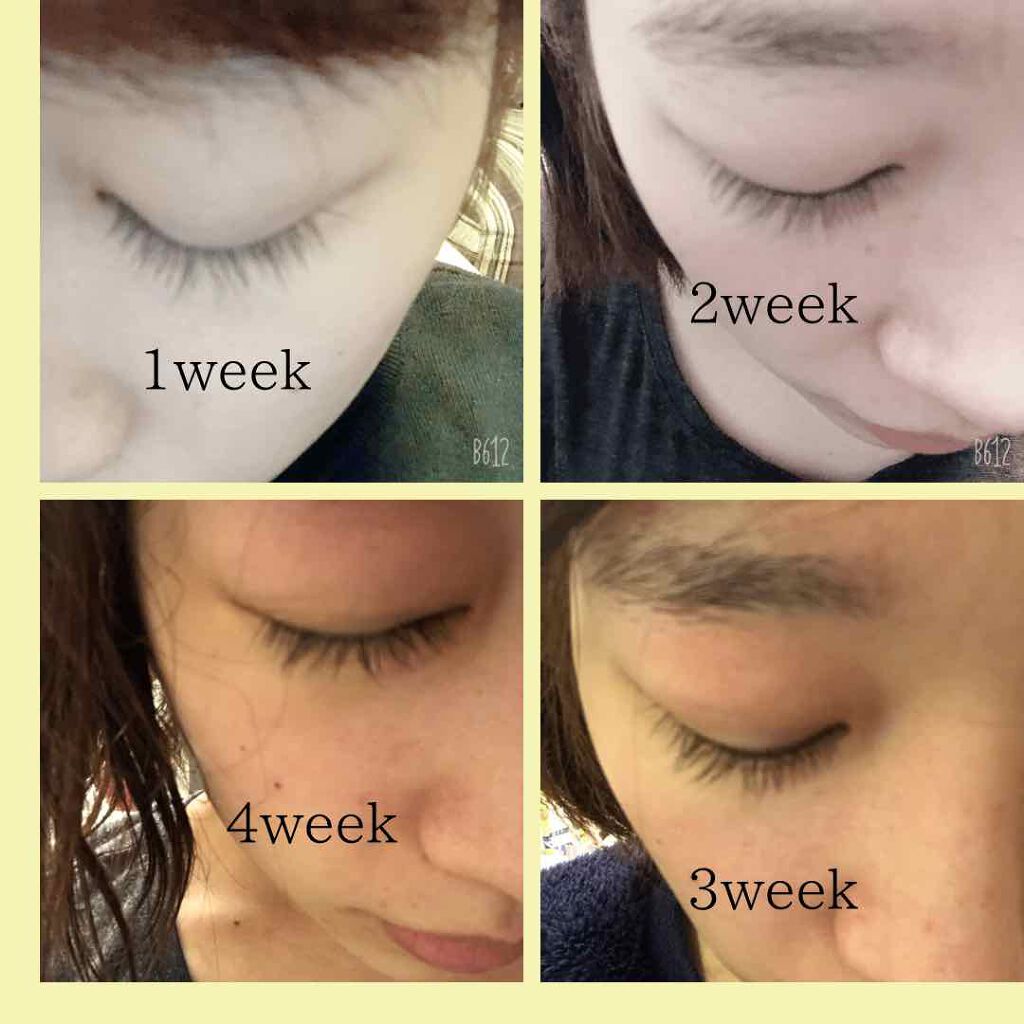 スカルプD ボーテ ピュアフリーアイラッシュセラム プレミアム/アンファー(スカルプD)/まつげ美容液を使ったクチコミ(2枚目)