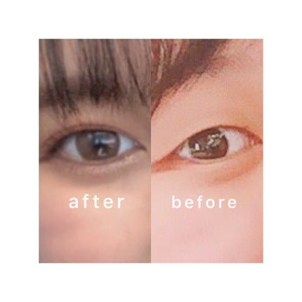 アイトーク スーパーホールド/アイトーク/二重まぶた用アイテムを使ったクチコミ(1枚目)