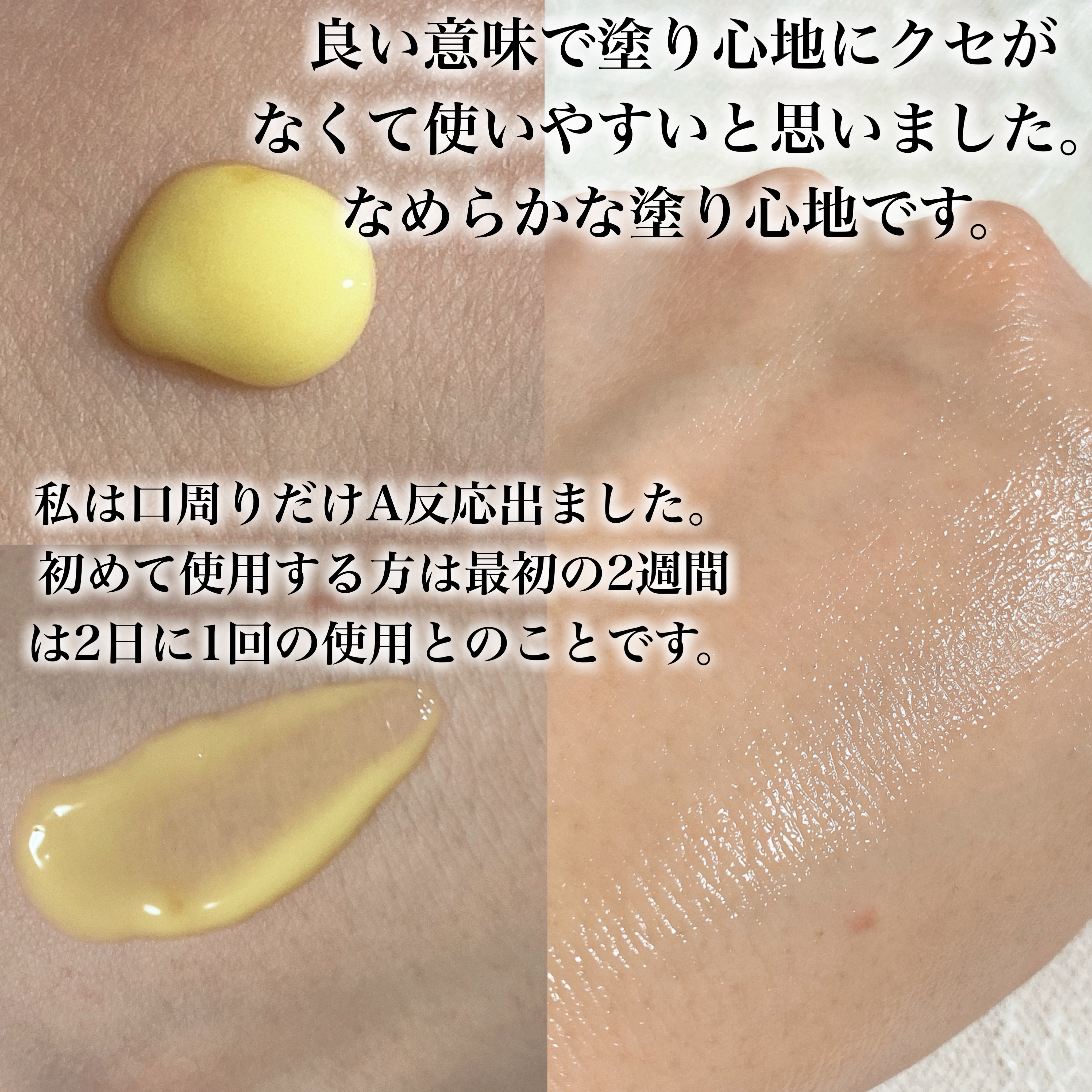 レチノール0.3 ナイアシンリニューイングセラム/Anua/美容液を使ったクチコミ（3枚目）