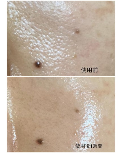 パンテショット675/COSNORI/美容液を使ったクチコミ(3枚目)