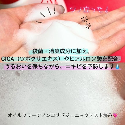 薬用化粧水/スキンライフ/化粧水を使ったクチコミ(5枚目)