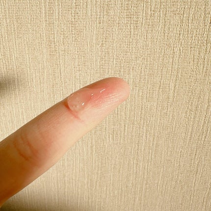 fractionalCC ニードルセラムC/fractionalCC/美容液を使ったクチコミ(3枚目)