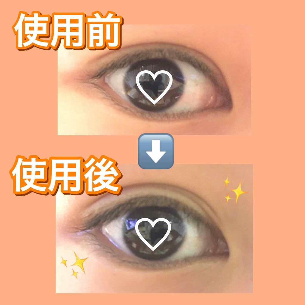 リキッドフィルム/ラクオリ/二重まぶた用アイテムを使ったクチコミ（2枚目）