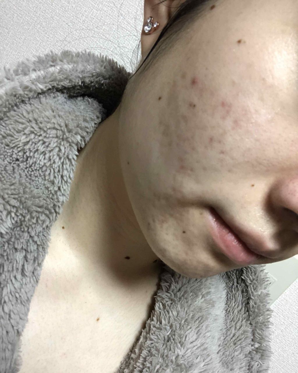 マンスリースキンケアプログラム(旧)/APEX/スキンケアキットを使ったクチコミ（3枚目）