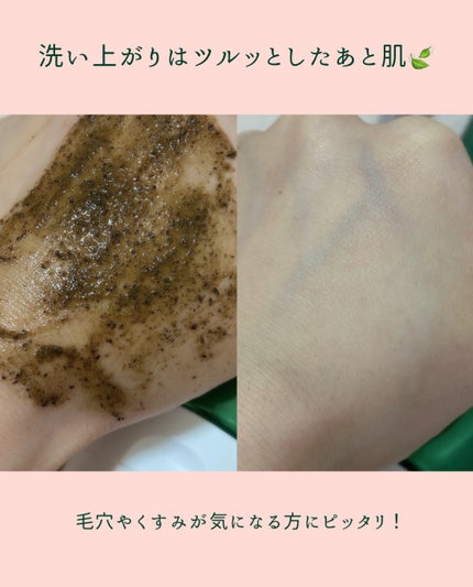 ティーツリーハーブピーリングパック/WellDerma/洗い流すパック・マスクを使ったクチコミ(4枚目)