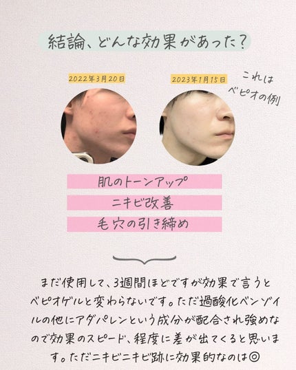 りん on LIPS 「rin_akanukerin_akanuke☚他の投稿はこちら..」(7枚目)