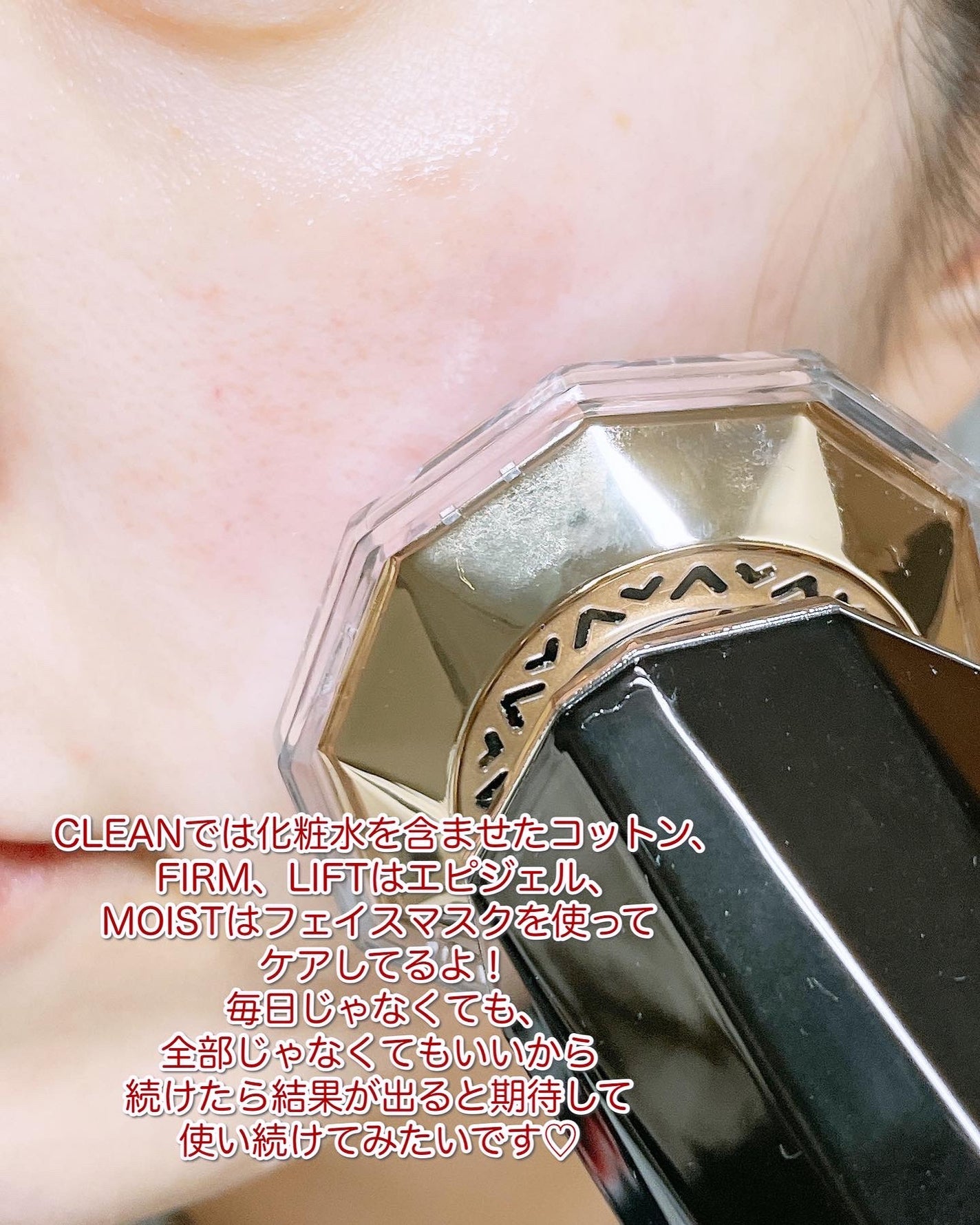 RF温冷美顔器PRO/ANLAN/美顔器・マッサージを使ったクチコミ(9枚目)