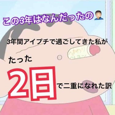 ずっと片方だけ一重でずっとアイプチをしてた
私がたったの2日で二重になれた訳を紹介します！！
うっそだぁ〜って思ったでしょ？私も全く信用しておらずそのまま三年すぎました😊100円で買えるのでうまくいかな