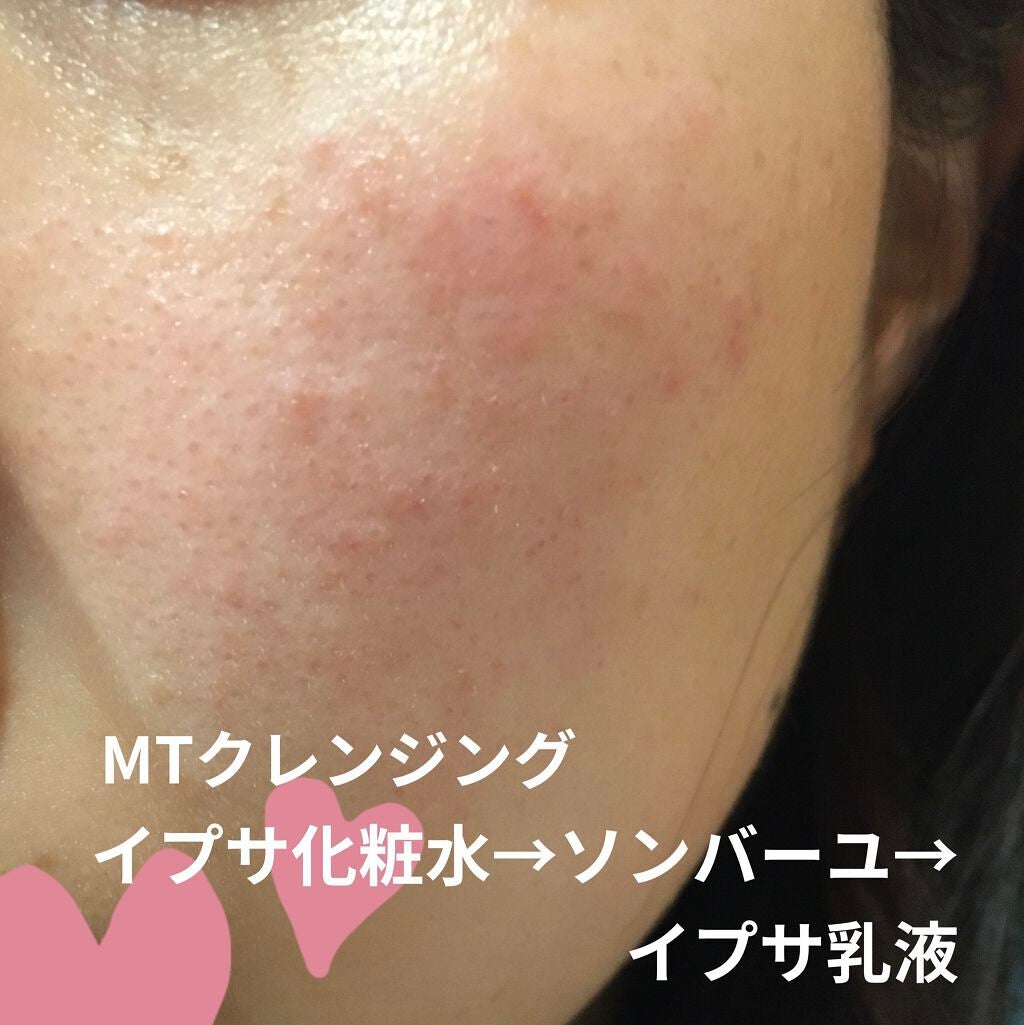 MT クレンジング・ジェル/MTメタトロン/クレンジングジェルを使ったクチコミ(1枚目)