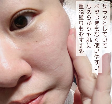 Solaris★フォロバ on LIPS 「毛穴悩みのある方必見!。・:*:・゚★,。・:*:・゚☆。・:..」(5枚目)