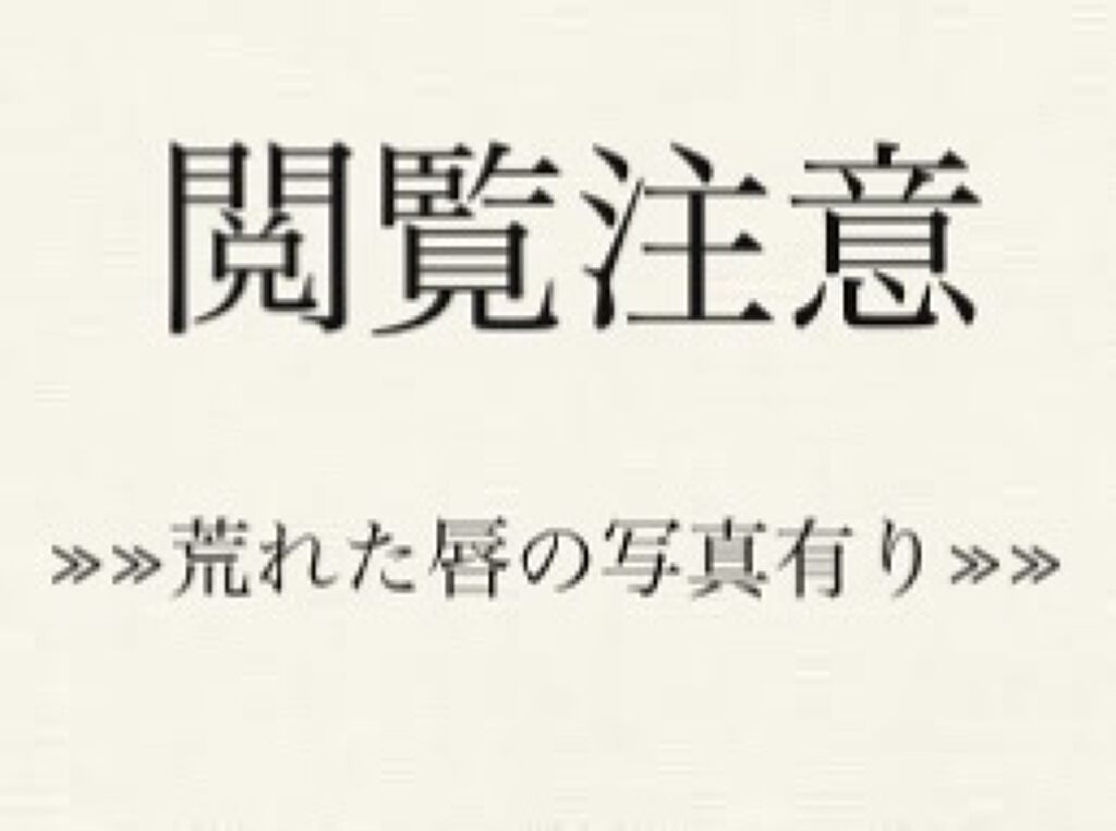 シュミテクト やさしく ホワイトニング/シュミテクト/歯磨き粉を使ったクチコミ（2枚目）