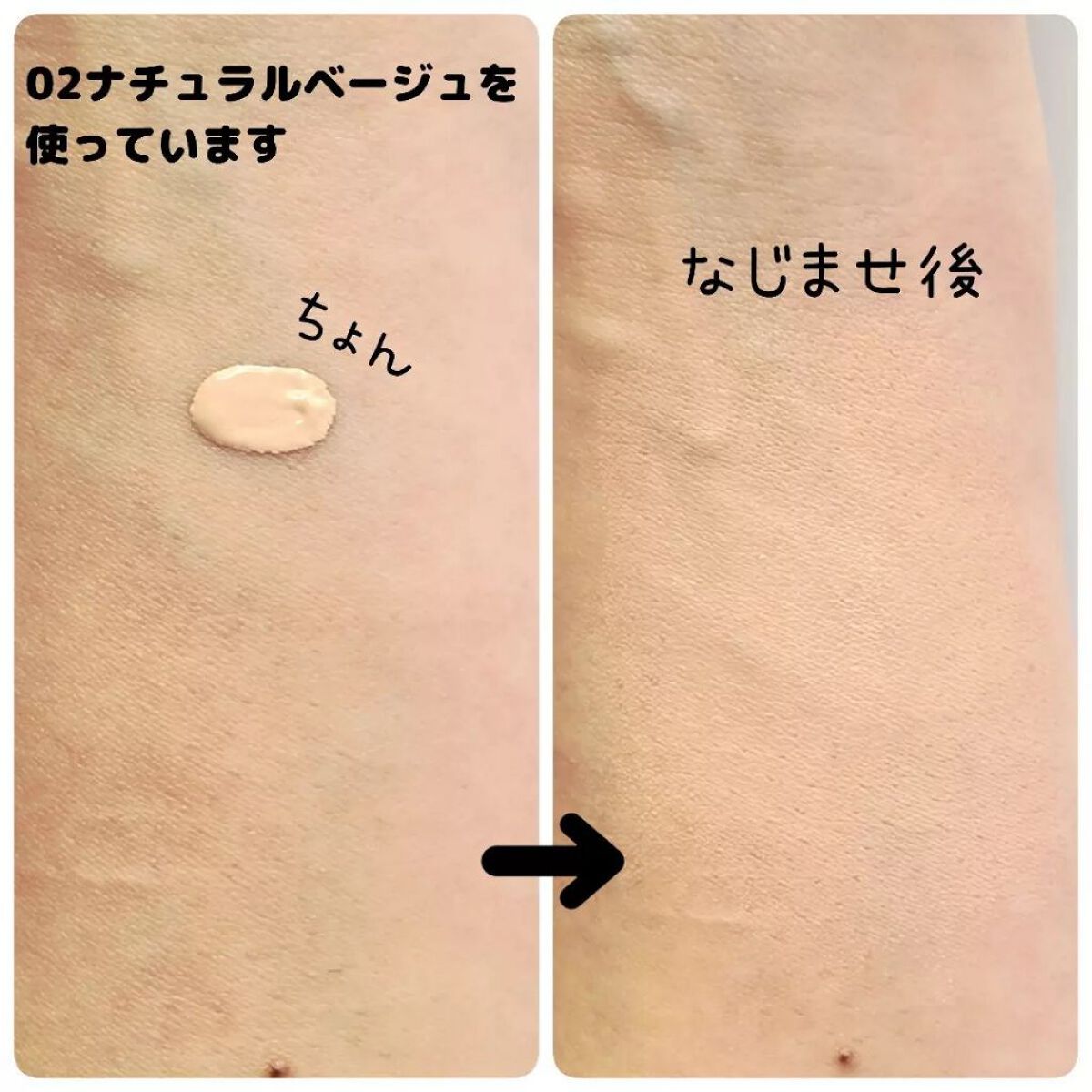 タトゥーウォータープルーフスカーコンシーラー/フォレンコス/リキッドコンシーラーを使ったクチコミ(3枚目)