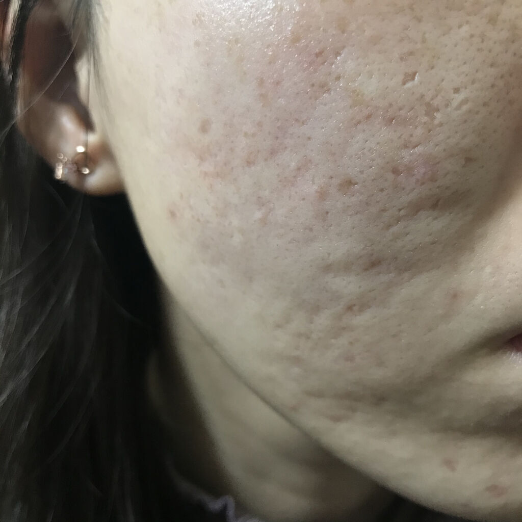 トーンアップカラープライマー /Ririmew/化粧下地を使ったクチコミ（3枚目）