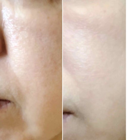 エッセンスビューティ パウダー/セラフォア/プレストパウダーを使ったクチコミ(3枚目)