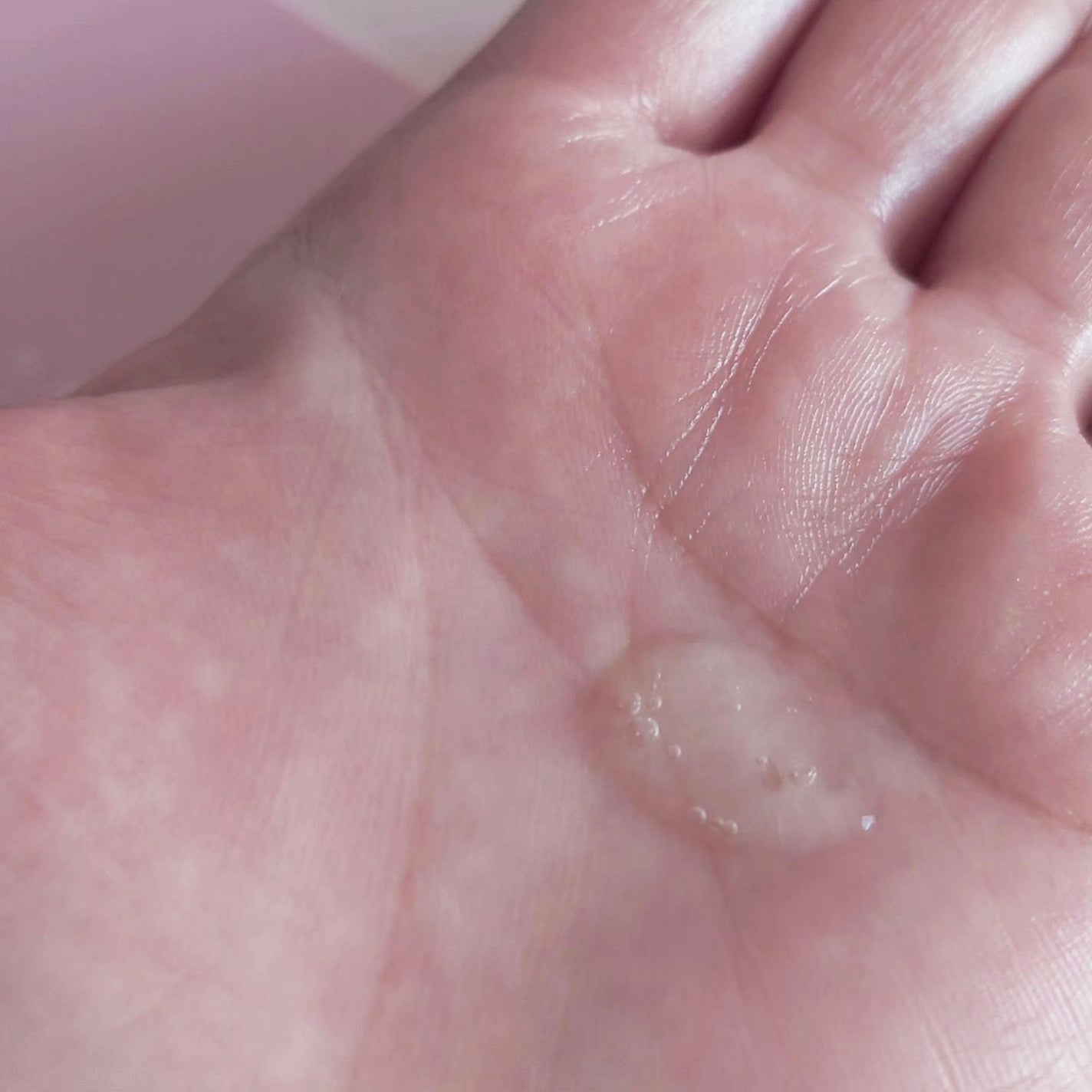 ティーツリーバイオームブレミッシュシカジェルクレンザー/MEDIHEAL/クレンジングジェルを使ったクチコミ(4枚目)