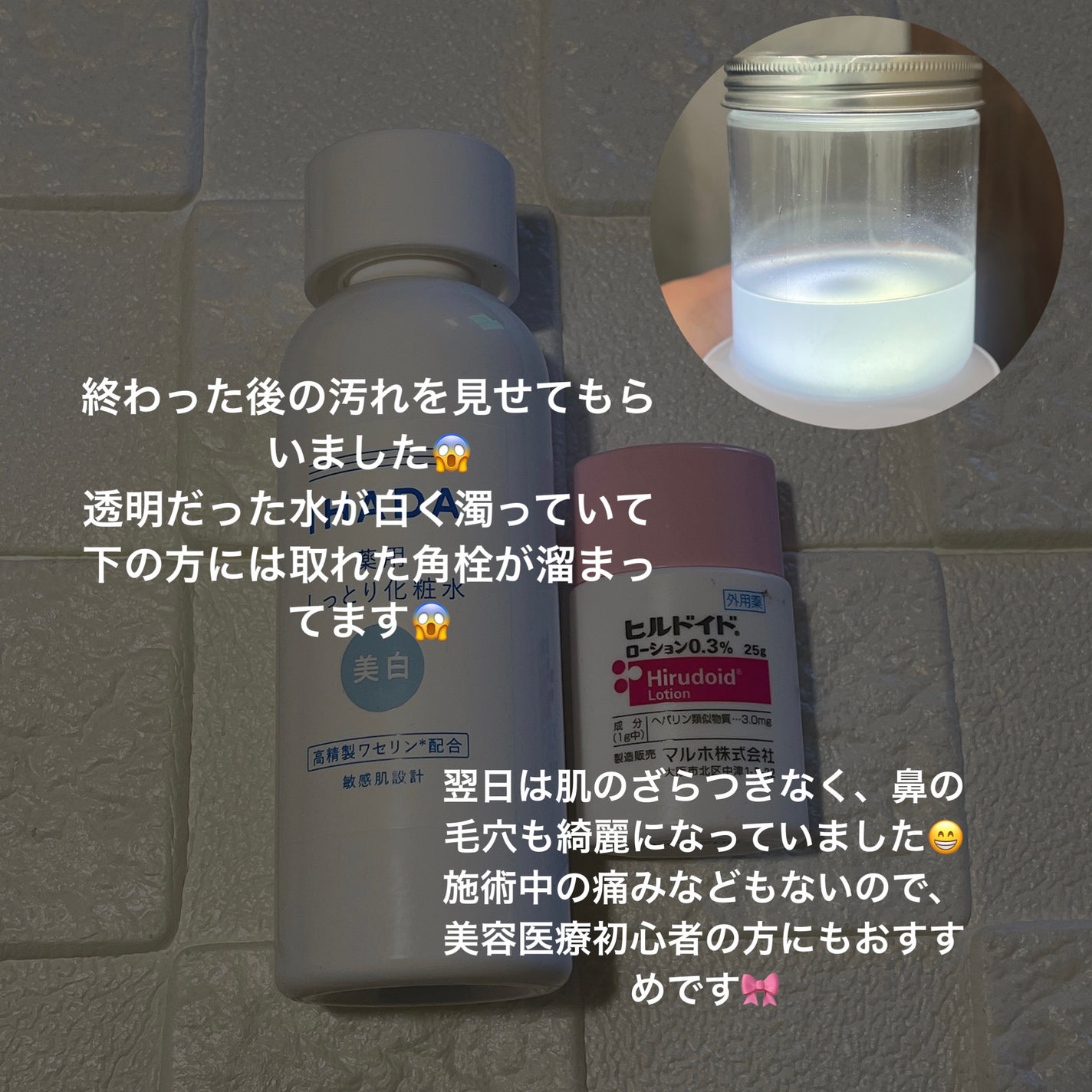 薬用クリアローション|IHADAの口コミ - 先日ハイドラ 薬用クリアローション|IHADAの口コミ - 先日ハイドラ