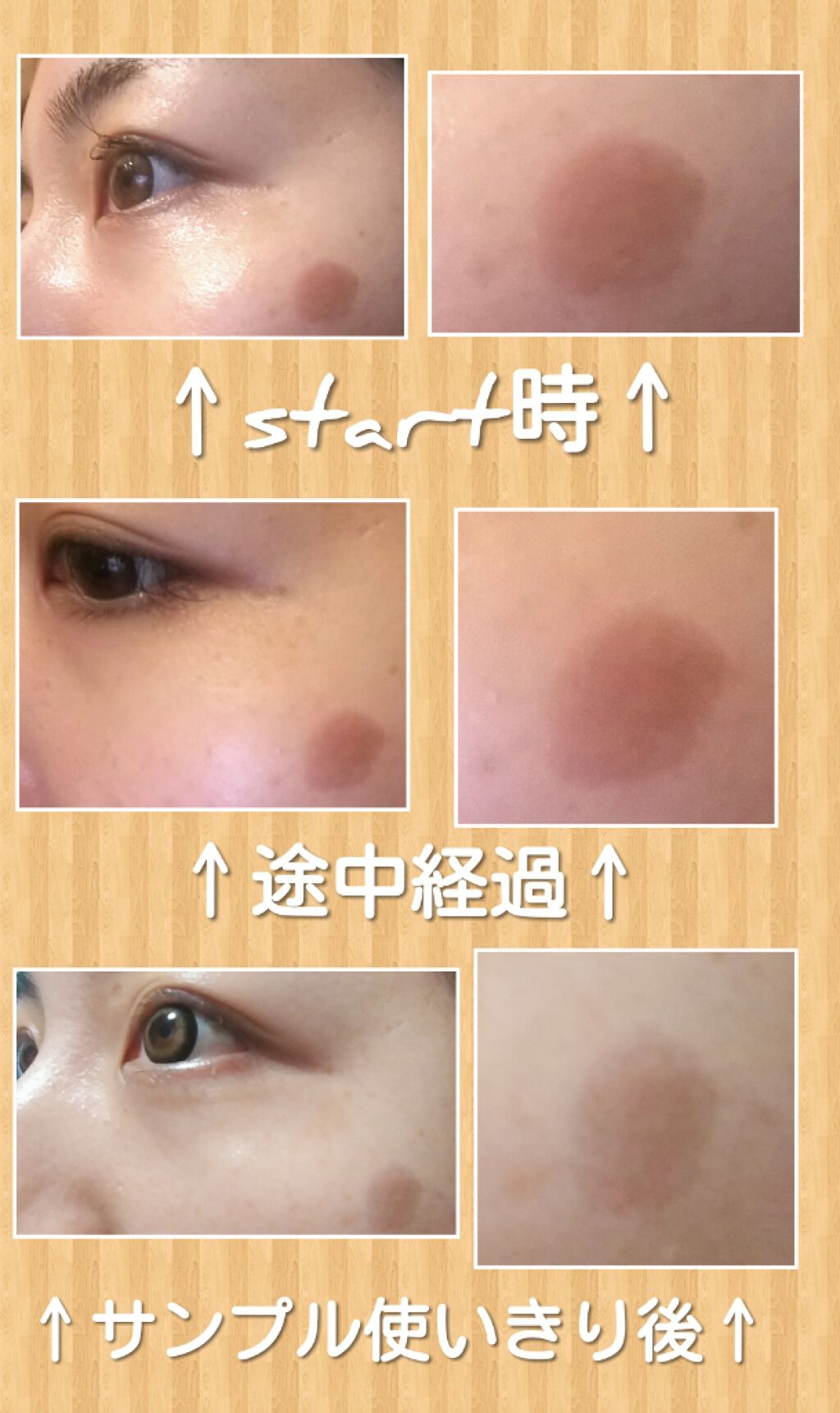 メラノフォーカスV/HAKU/美容液を使ったクチコミ(2枚目)