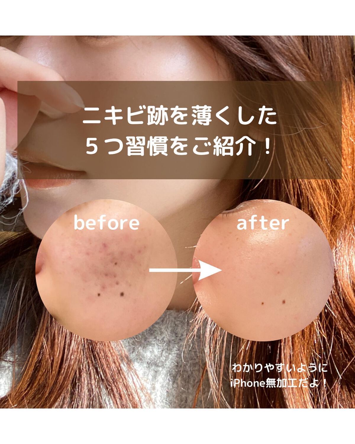 ガラクナイアシン2.0エッセンス/manyo/美容液を使ったクチコミ（2枚目）