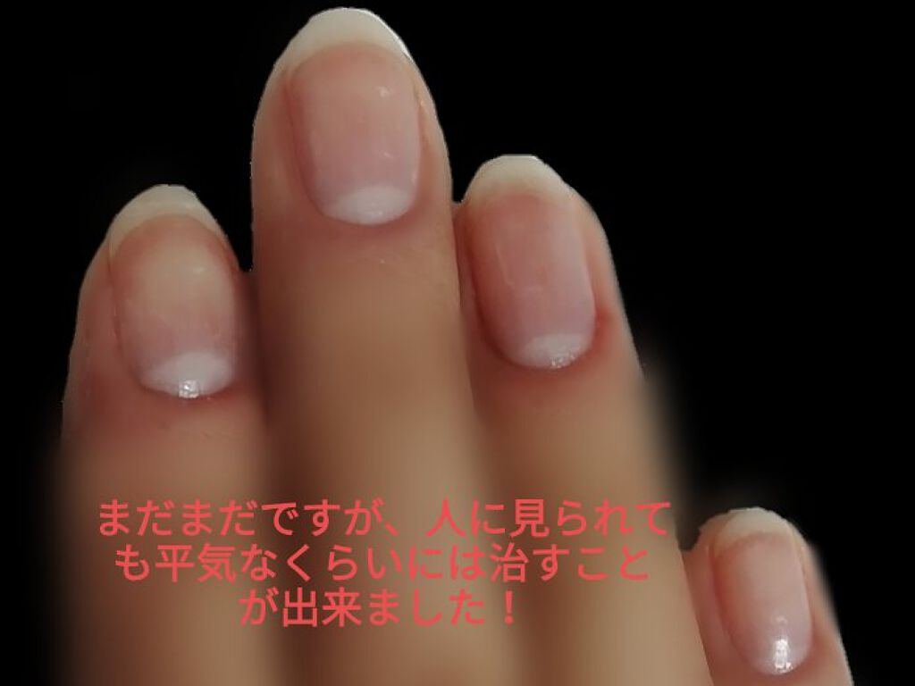 ニベアクリーム/ニベア/ボディクリームを使ったクチコミ（3枚目）