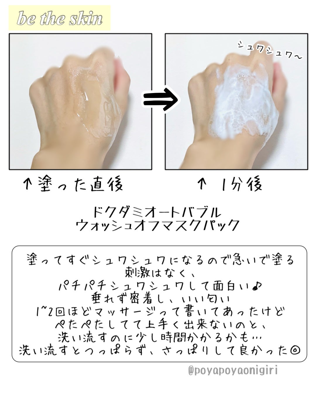 ドクダミオートバブルウォッシュオフマスクパック/be the skin/洗い流すパック・マスクを使ったクチコミ(3枚目)