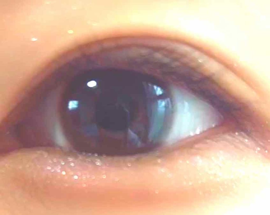 のびーるアイテープ（絆創膏タイプ、レギュラー）/DAISO/二重まぶた用アイテムを使ったクチコミ（1枚目）