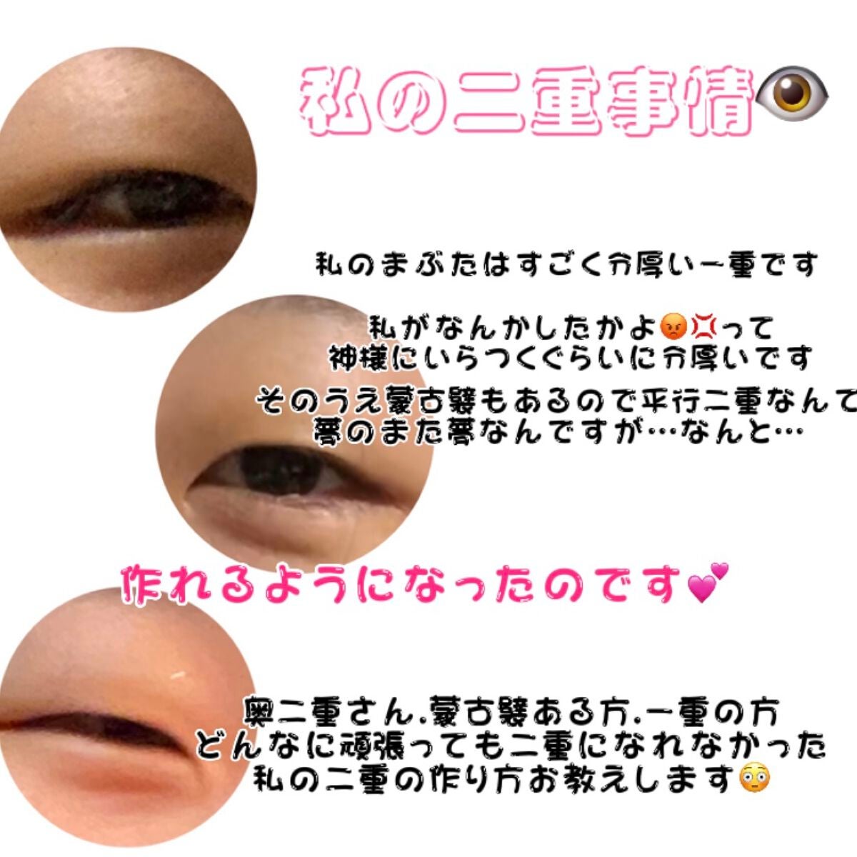 アイトーク/アイトーク/二重まぶた用アイテムを使ったクチコミ(2枚目)