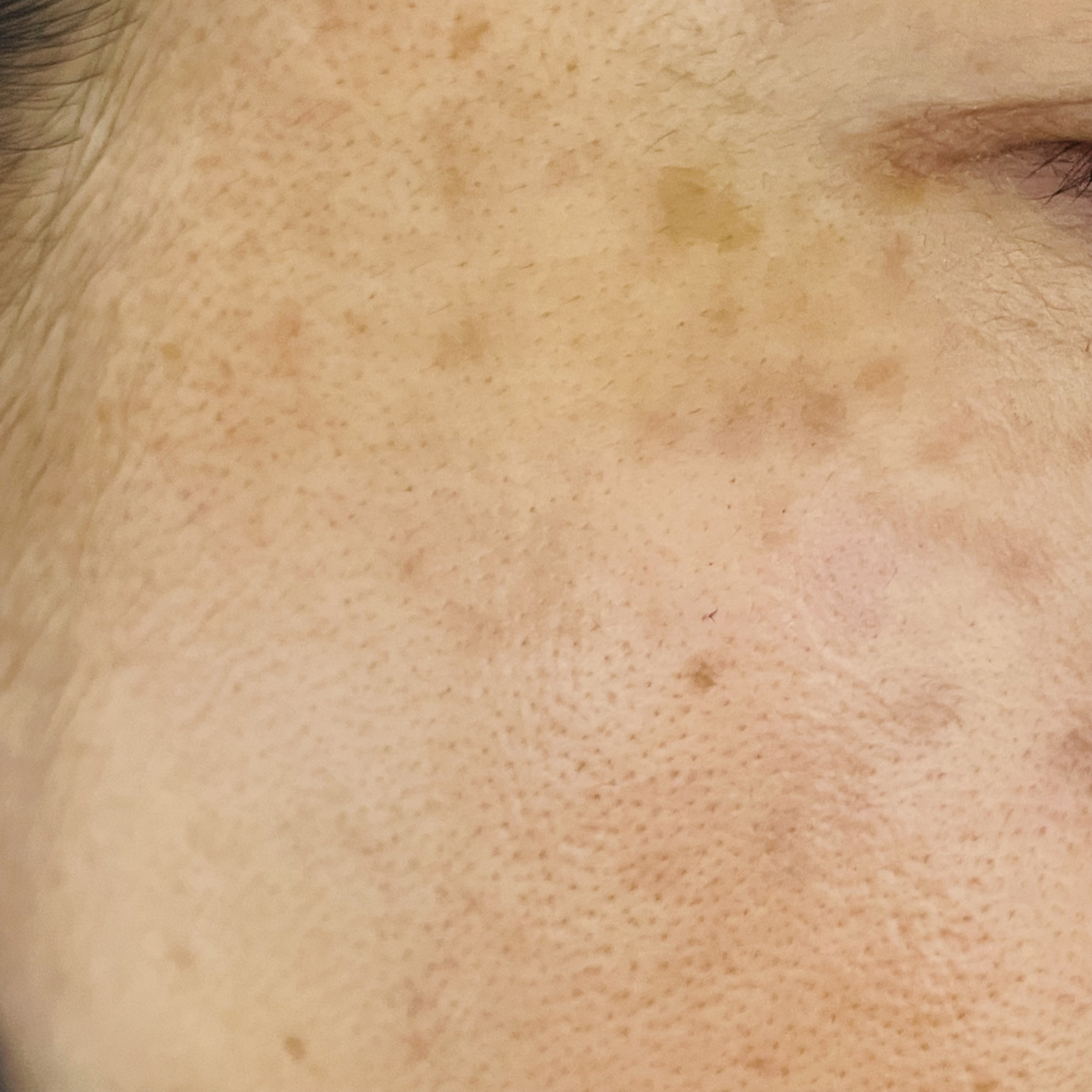 薬用 美白美容液ファンデ（医薬部外品）/HAKU/クリーム・エマルジョンファンデーションを使ったクチコミ（2枚目）