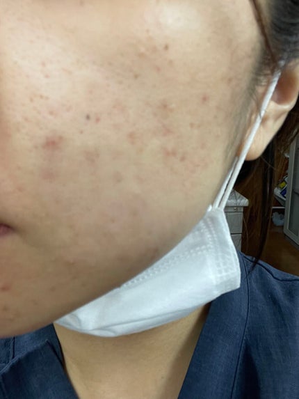 を使ったクチコミ(3枚目)