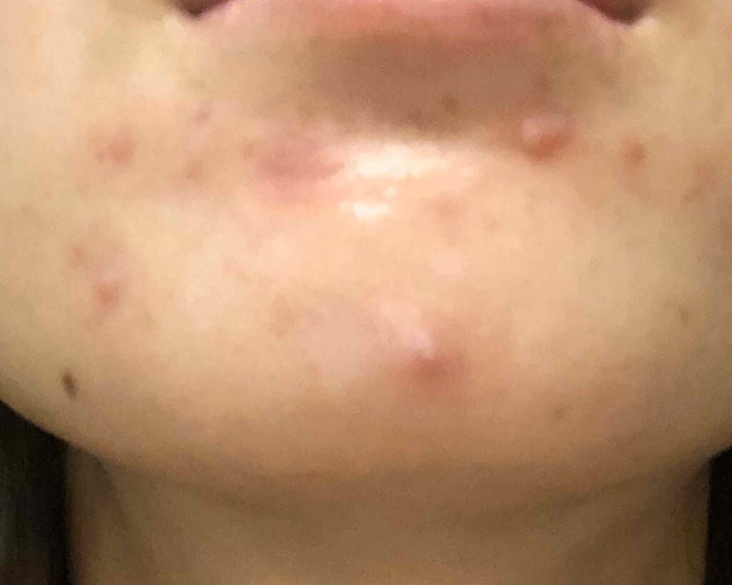 Cセラム/b.glen/美容液を使ったクチコミ(2枚目)