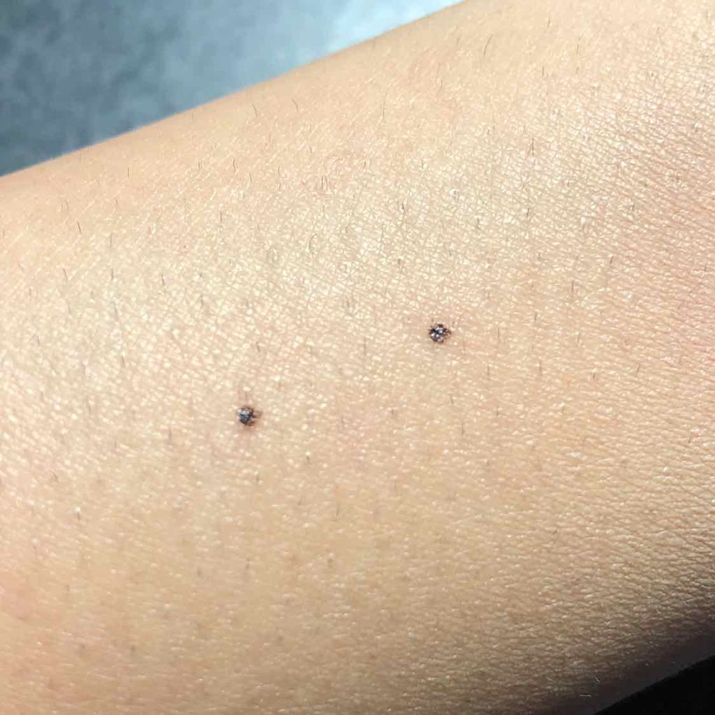 マジックコンシーラー/カリプソ/リキッドコンシーラーを使ったクチコミ(3枚目)