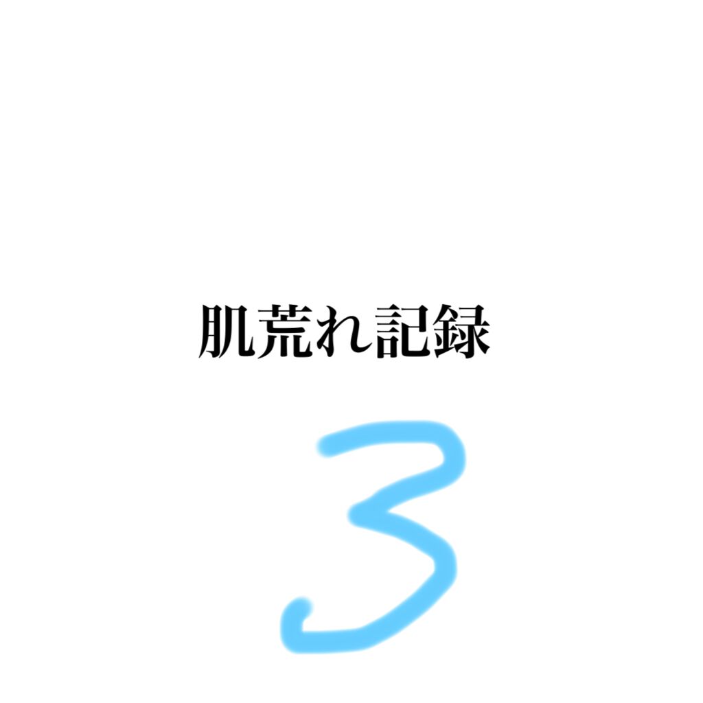 アクネケアローション W/d プログラム/化粧水を使ったクチコミ（1枚目）