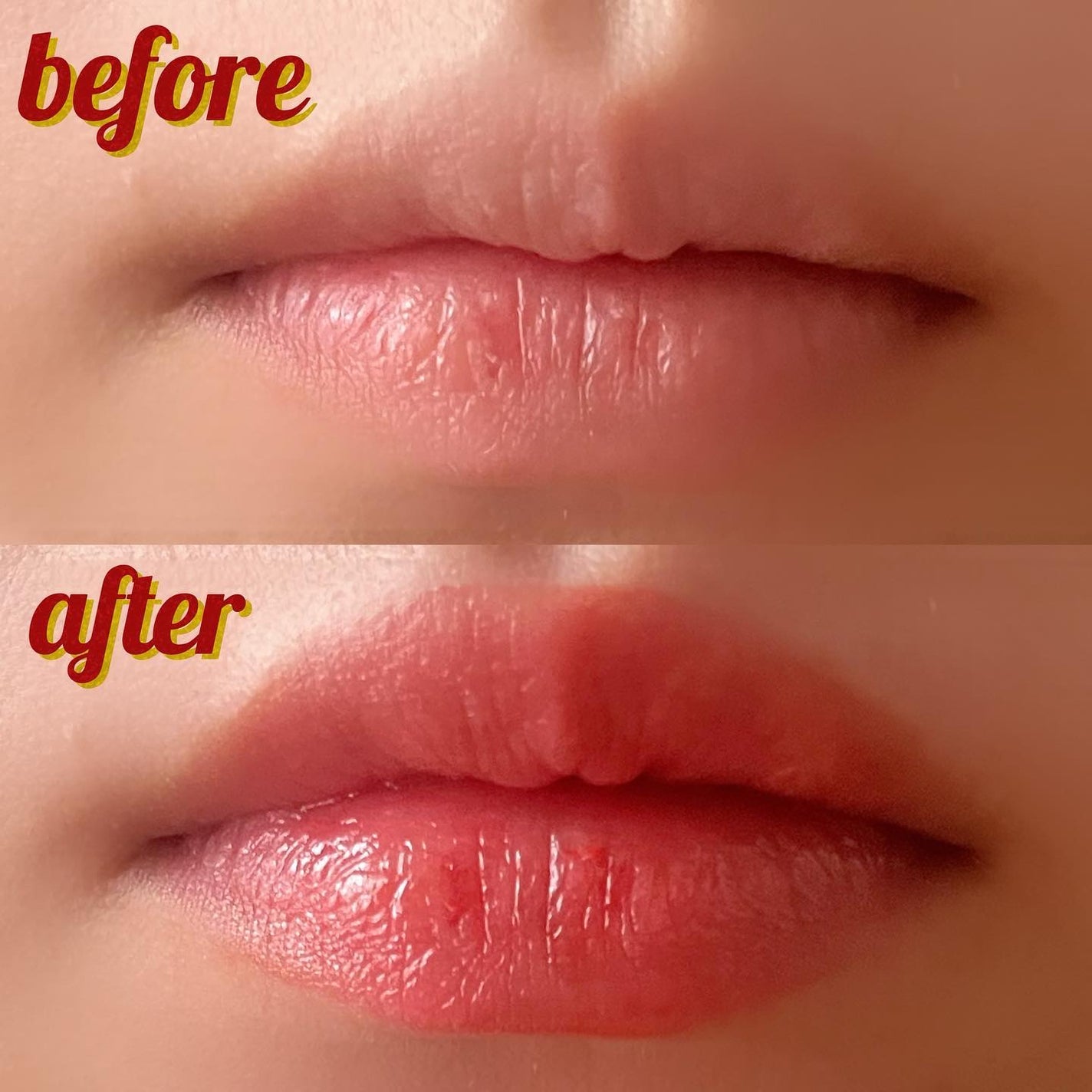 ドトムリッププラスプランパー/keybo/リッププランパーを使ったクチコミ(2枚目)