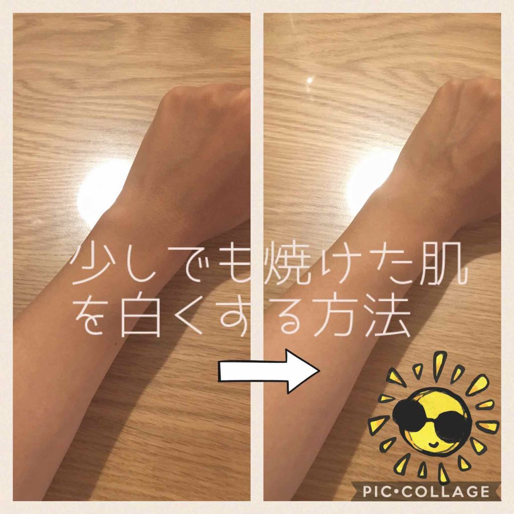 美白になる方法 ビタミンc ハードカプセル Dhcの美白効果 使い方 焼けた肌を少しでも白 By かっぱさん 脂性肌 Lips