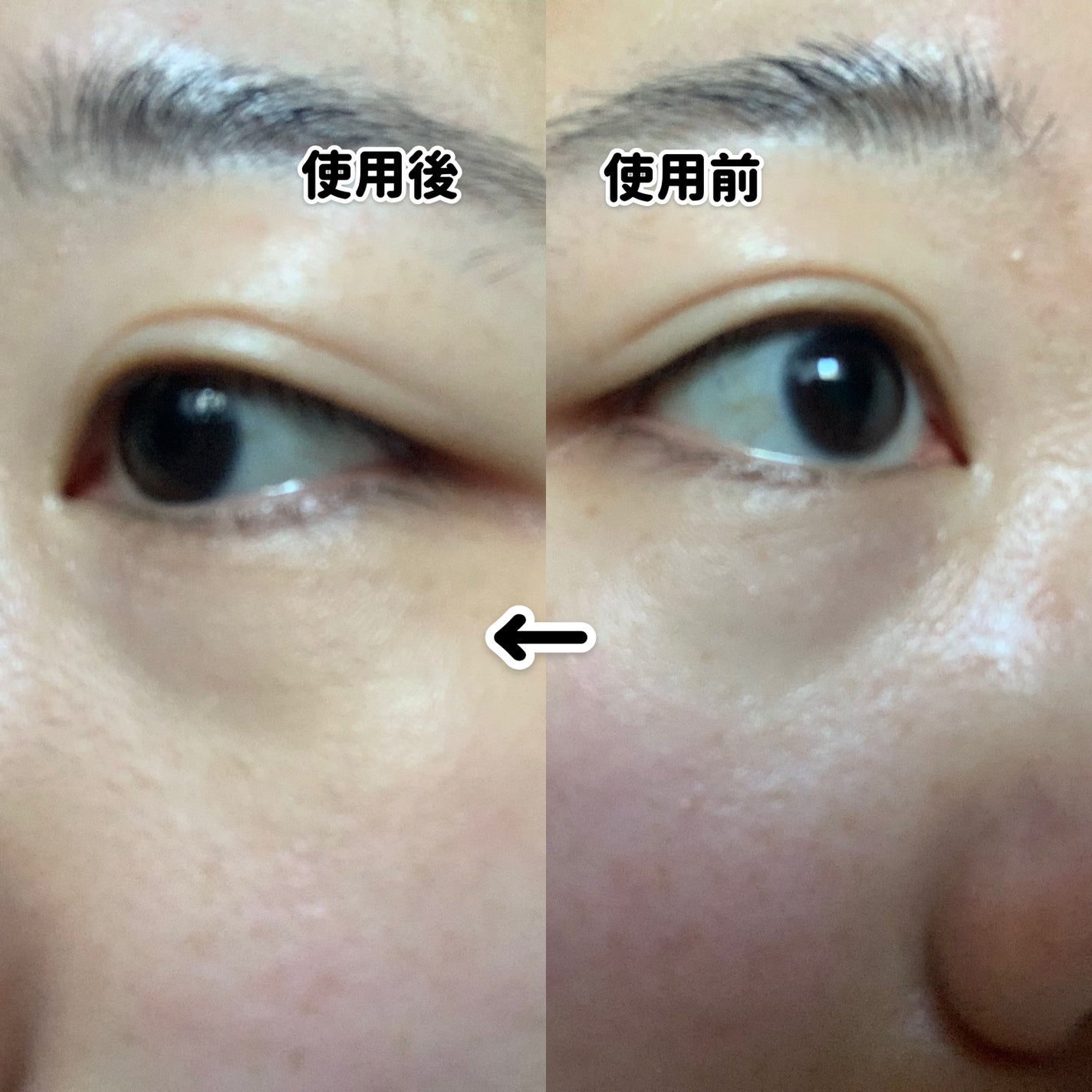 カバーアッププロコンシーラー/TFIT/パレットコンシーラーを使ったクチコミ(5枚目)