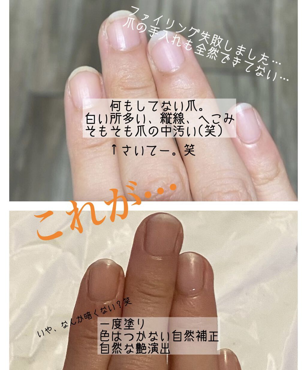 ディーアップファンデーション D Upの口コミ 美意識は爪にでる 素爪も美しく D Up By ちゃそ 混合肌 30代前半 Lips
