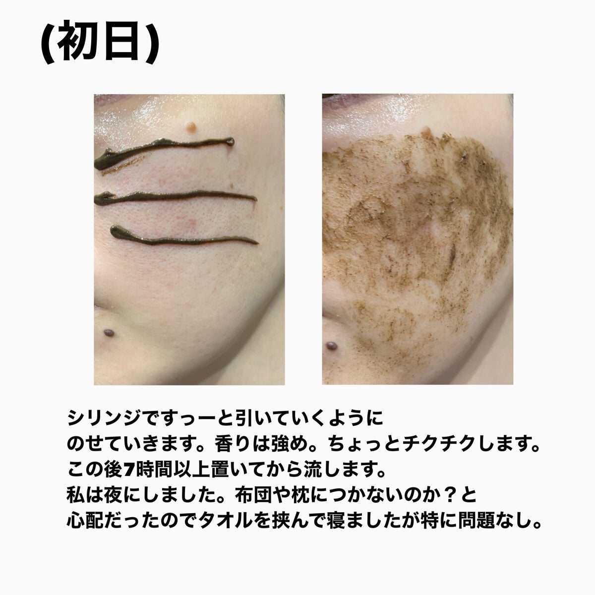 ダーマスキンピーリング/BQCELL/その他キットセットを使ったクチコミ(3枚目)