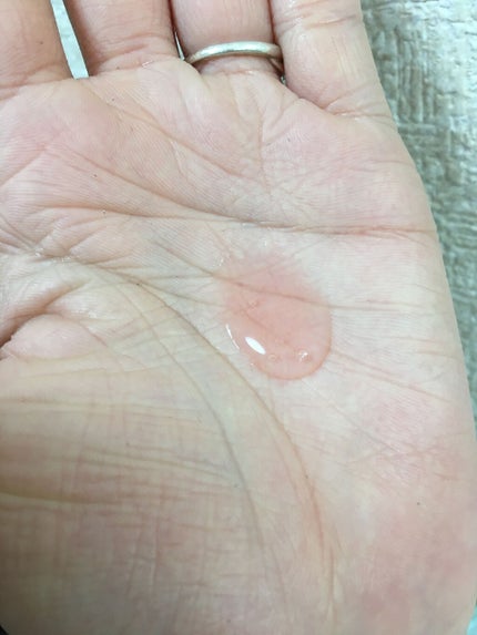 レッド プロポリス エキスパート アンプル/CNP Laboratory/美容液を使ったクチコミ(2枚目)