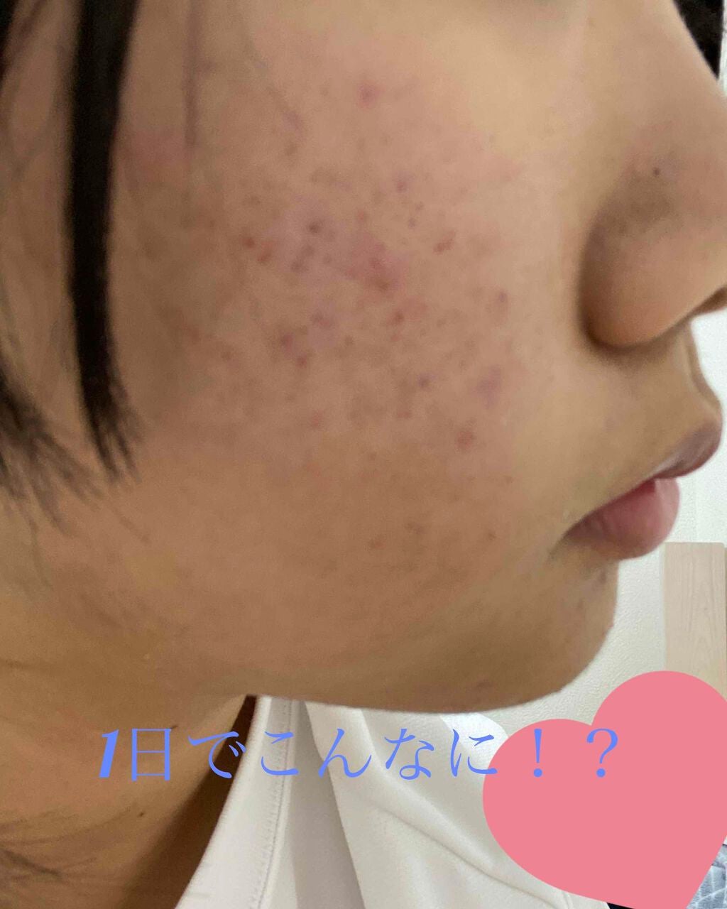 白色ワセリン(医薬品)/健栄製薬/その他を使ったクチコミ(2枚目)