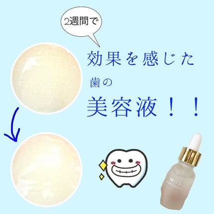 ホワイティエッセンス/MiiS/その他オーラルケアを使ったクチコミ(1枚目)