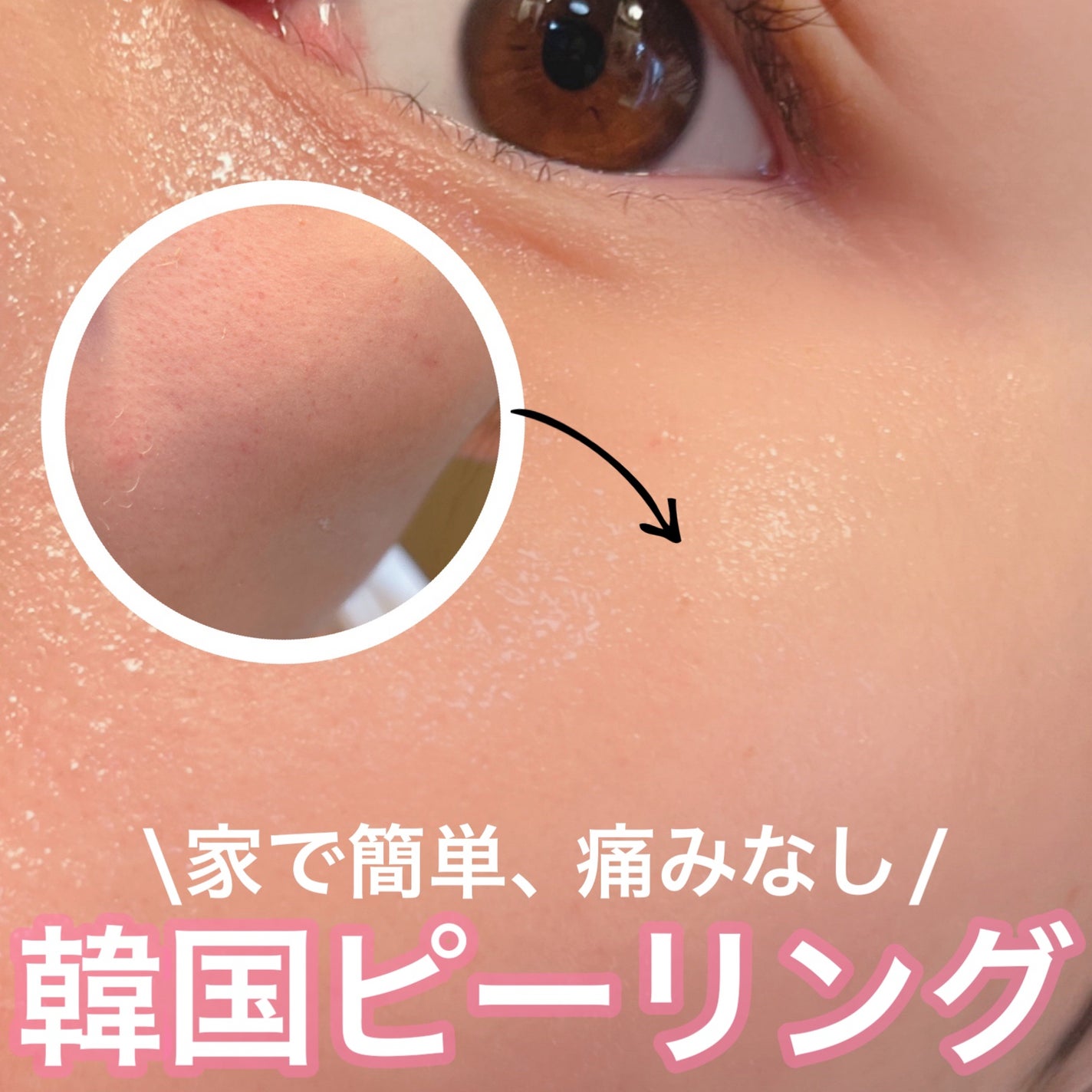 ダーマスキンピーリング/BQCELL/その他キットセットを使ったクチコミ(1枚目)