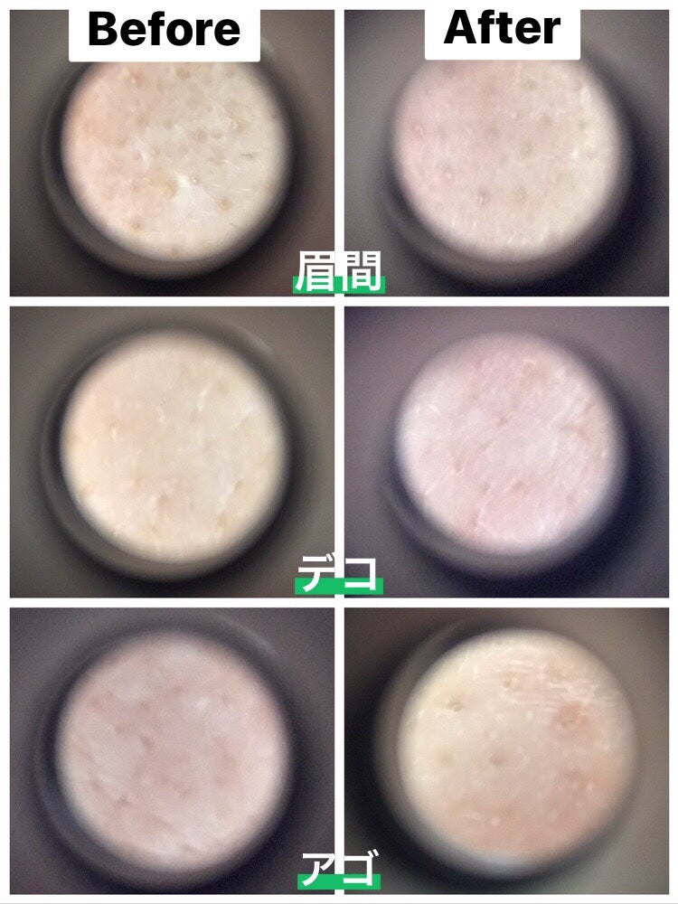 シカレチA エッセンス0.1/VT/美容液を使ったクチコミ(4枚目)