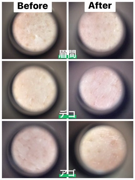 シカレチA エッセンス0.1/VT/美容液を使ったクチコミ(4枚目)