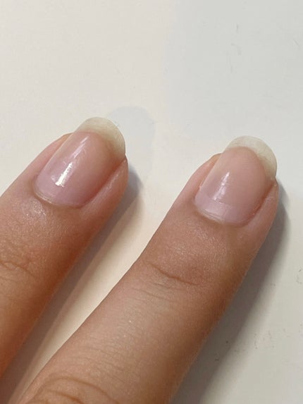 自爪補強コート/デュカート/ネイルベースコートを使ったクチコミ(2枚目)