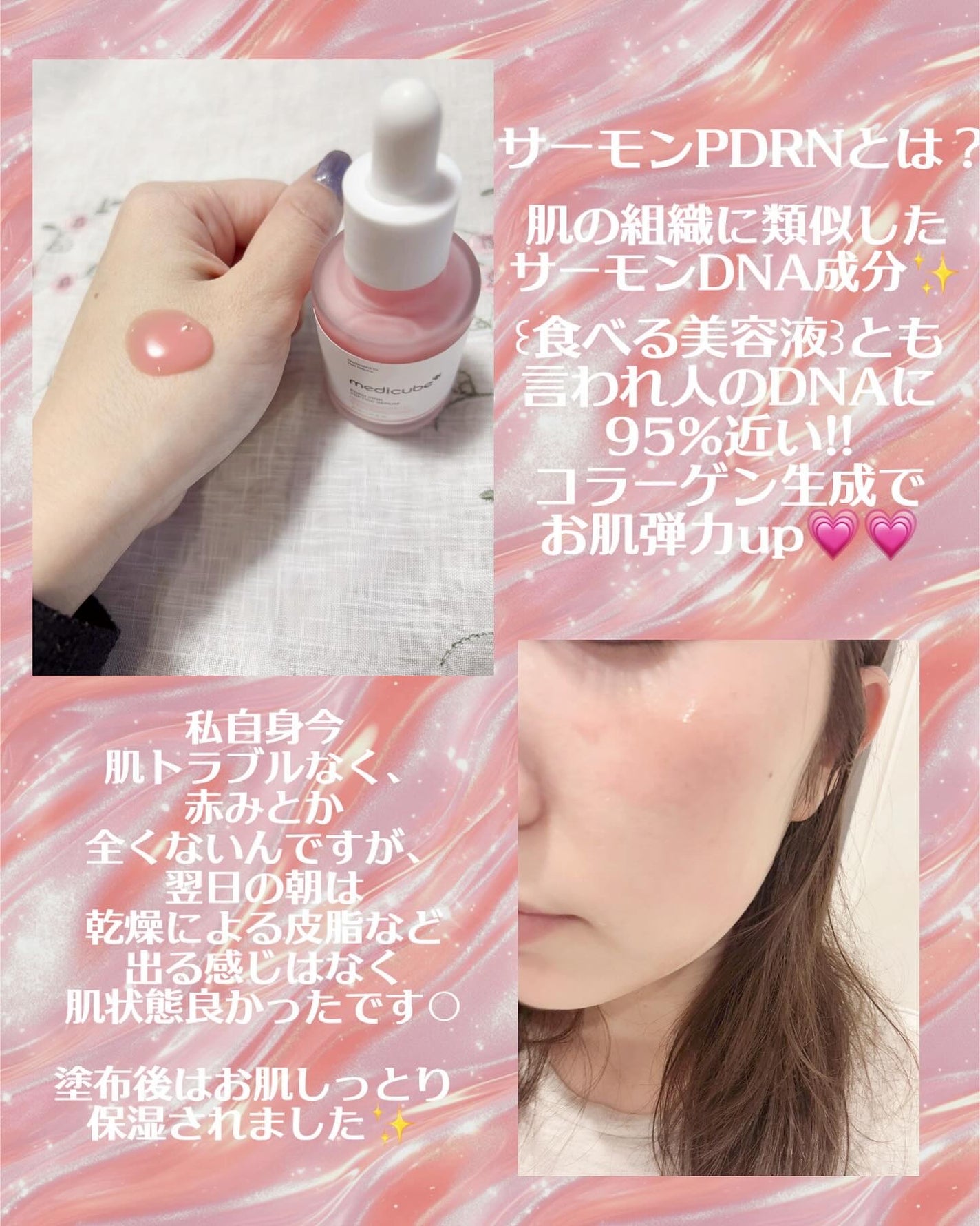 PDRNピンクアンプル PDRN 10,000ppm配合/MEDICUBE/美容液を使ったクチコミ(2枚目)