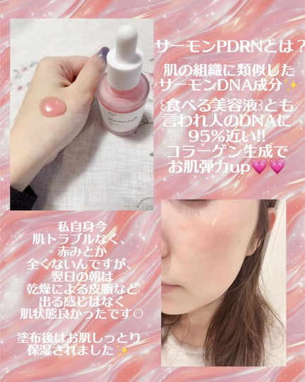 PDRNピンクアンプル PDRN 10,000ppm配合/MEDICUBE/美容液を使ったクチコミ(2枚目)