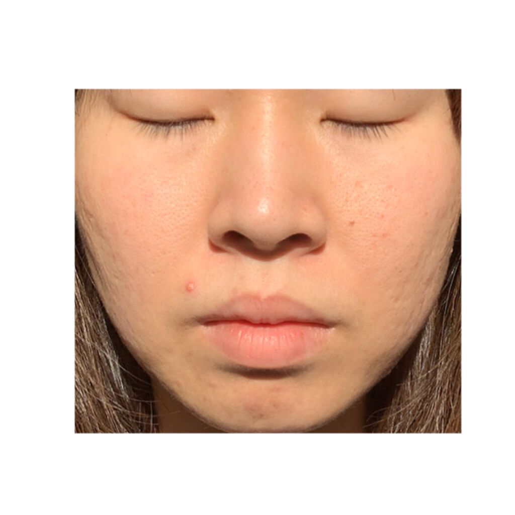 リアルカロテンブレミッシュクリアセラム/APRILSKIN/美容液を使ったクチコミ(8枚目)